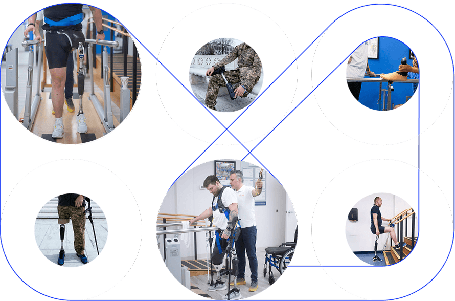 Протезування нижніх кінцівок