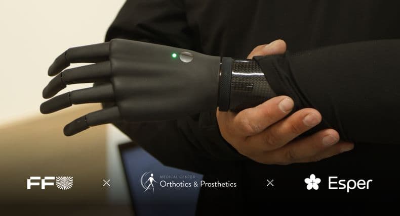 Захисники отримали безоплатні біонічні кисті від Esper Bionics