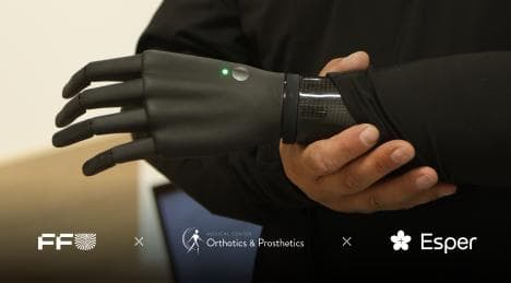 Захисники отримали безоплатні біонічні кисті від Esper Bionics
