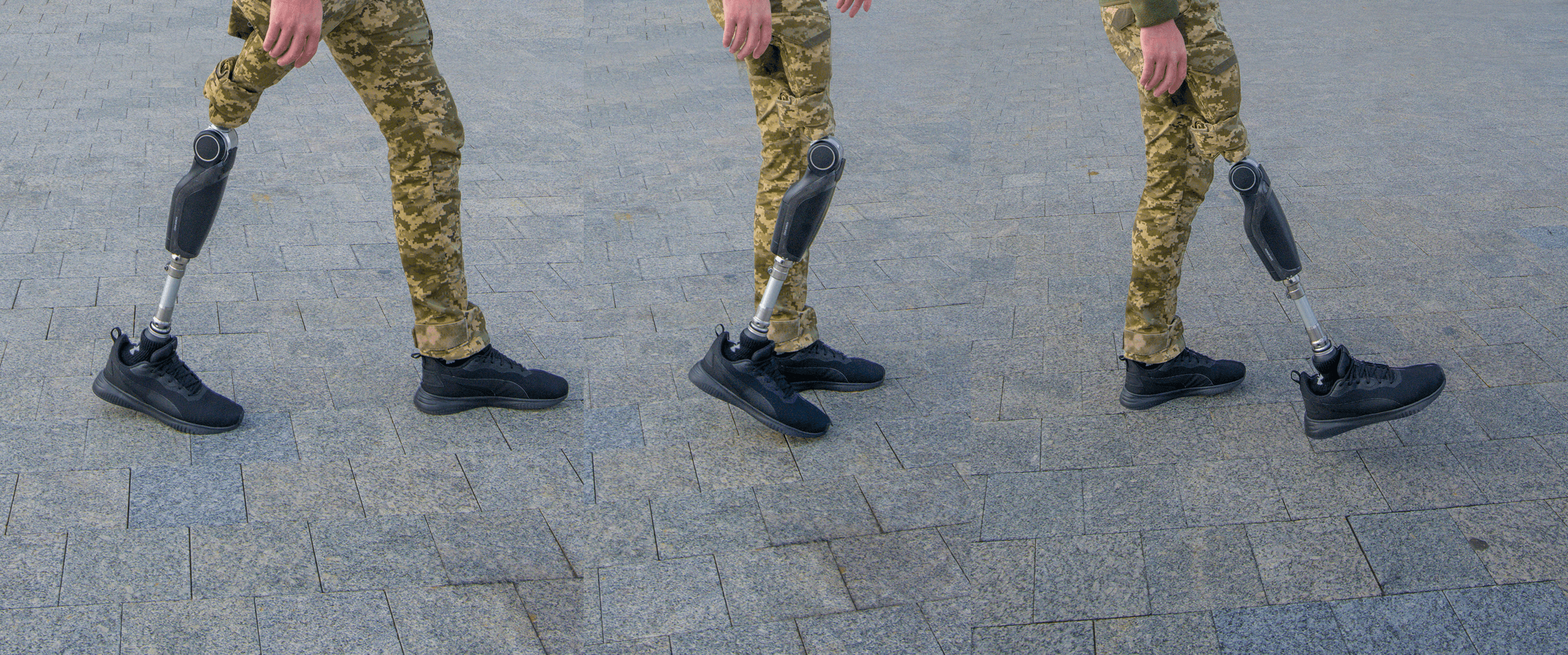 Prosthetics of Ukrainians