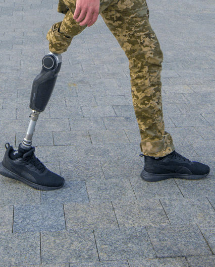 Протезування українців - 310x385