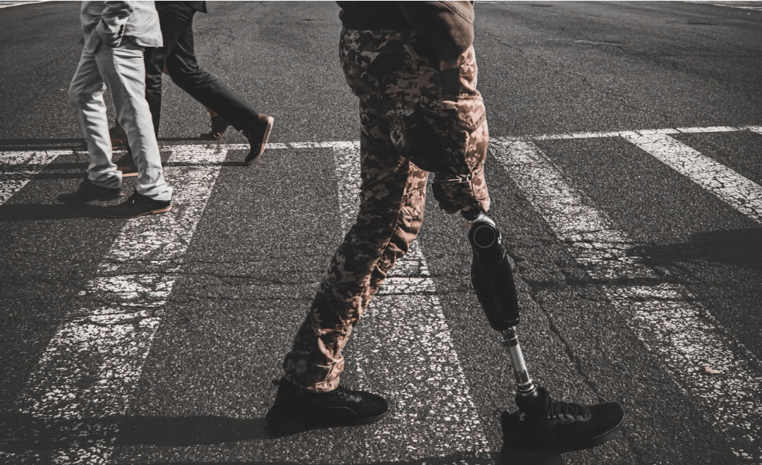 FFU | Prosthetics of severely wounded soldiers