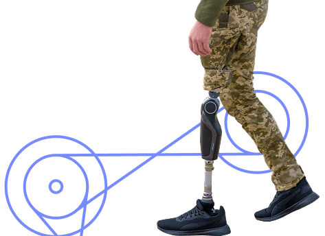 A veteran with a prosthesis — support for complex prosthetic care