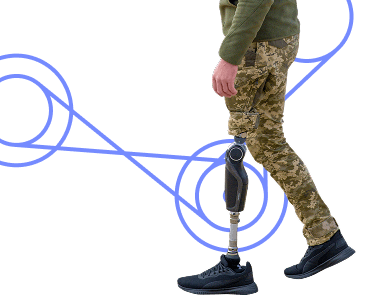 A veteran with a prosthesis — support for complex prosthetic care